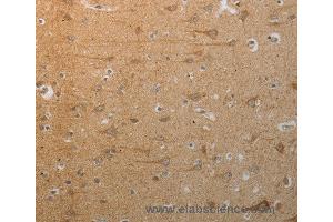 Immunohistochemistry of Human tonsil using SLC4A7 Polyclonal Antibody at dilution of 1:50