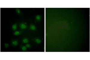 Immunofluorescence analysis of HuvEc cells, using NIFK (Phospho-Thr234) Antibody. (NIFK antibody  (pThr234))