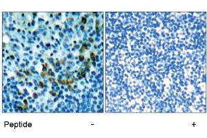 Image no. 1 for anti-zeta-Chain (TCR) Associated Protein Kinase 70kDa (ZAP70) (Tyr319) antibody (ABIN197385) (ZAP70 antibody  (Tyr319))