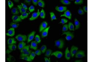 Immunofluorescence staining of A549 cells with ABIN7153435 at 1:133, counter-stained with DAPI. (GALR2 antibody  (AA 282-387))