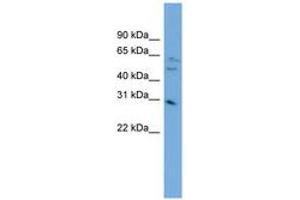 Image no. 1 for anti-mRNA Turnover 4 Homolog (MRTO4) (AA 143-192) antibody (ABIN6744820) (C1orf33 antibody  (AA 143-192))