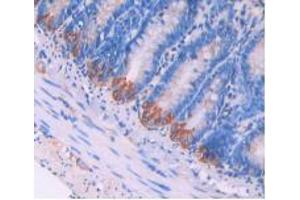 IHC-P analysis of Rat Intestine Tissue, with DAB staining. (LAMP2 antibody  (AA 191-362))