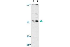 Western blot analysis of MATN3 in NIH/3T3 cell lysate with MATN3 polyclonal antibody  at (A) 1 and (B) 2 ug/mL .
