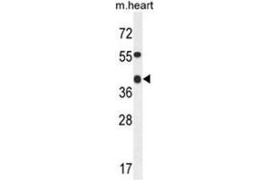 ADH4 Antibody (C-term) western blot analysis in mouse heart tissue lysates (35µg/lane).