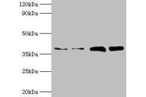Western blot All lanes: TBCC antibody at 2 μg/mL Lane 1: Hela whole cell lysate Lane 2: HepG2 whole cell lysate Lane 3: A549 whole cell lysate Lane 4: MCF-7 whole cell lysate Secondary Goat polyclonal to rabbit IgG at 1/10000 dilution Predicted band size: 40 kDa Observed band size: 40 kDa (TBCC antibody  (AA 2-346))