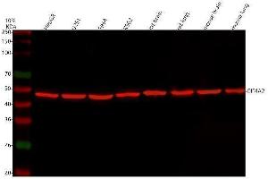 Western blot analysis of eIF4A2 using anti-eIF4A2 antibody (ABIN3043426). (EIF4A2 antibody  (N-Term))