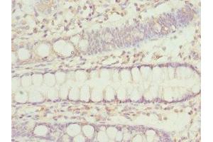 Immunohistochemistry of paraffin-embedded human colon tissue using ABIN7156305 at dilution of 1:100 (IP6K2 antibody  (AA 1-180))