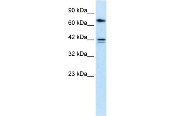 CACNB1 antibody  (N-Term)