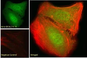 ABIN334426 Immunofluorescence analysis of paraformaldehyde fixed U2OS cells, permeabilized with 0. (ITCH antibody  (Internal Region))