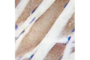 Immunohistochemical staining of formalin-fixed and paraffin-embedded human skeletal muscle tissue reacted with CLIC4 monoclonal antibody  at 1:50-1:100 dilution. (CLIC4 antibody)