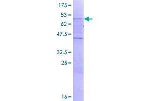 SMAP2 Protein (AA 1-429) (GST tag)