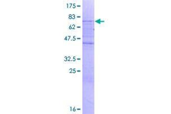 SMAP2 Protein (AA 1-429) (GST tag)