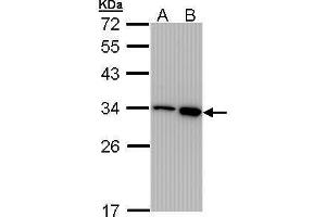 WB Image Sample (30 ug of whole cell lysate) A: 293T B: A431 , 12% SDS PAGE antibody diluted at 1:1000 (RPA2 antibody)