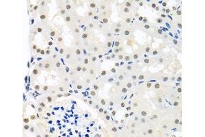Immunohistochemistry of paraffin-embedded Mouse kidney using THOC1 Polyclonal Antibody at dilution of 1:100 (40x lens). (THOC1 antibody)
