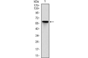Western blot analysis using ROCK1 antibody against HEK293 (1) and ROCK1 (AA: 403-610) -hIgGFc transfected HEK293 (2) cell lysate. (ROCK1 antibody)