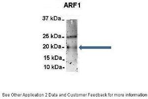 Immunoprecipitation (IP) image for anti-ADP-Ribosylation Factor 1 (ARF1) (Middle Region) antibody (ABIN2783267)