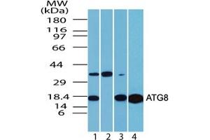 ATG8 Western Blot. (LC3B antibody  (N-Term))