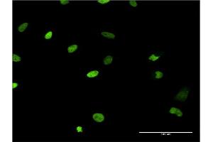 Immunofluorescence of monoclonal antibody to MCM6 on HeLa cell. (MCM6 antibody  (AA 1-821))