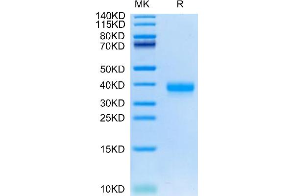 ANGPTL4 Protein (AA 164-406) (His tag)