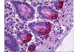 Human Intestine, Paneth Cells: Formalin-Fixed, Paraffin-Embedded (FFPE). (IL12A antibody)