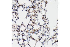 Immunohistochemistry of paraffin-embedded mouse lung using SFTP Rabbit pAb (ABIN3017436, ABIN3017437, ABIN3017438 and ABIN6220091) at dilution of 1:50 (40x lens). (Surfactant Protein A1 antibody)