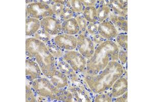 Immunohistochemistry of paraffin-embedded mouse kidney using NLRC4 antibody (ABIN5975127) at dilution of 1/100 (40x lens). (NLRC4 antibody)