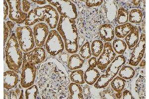 ABIN6273212 at 1/100 staining Human kidney tissue by IHC-P. (COLEC11 antibody  (C-Term))