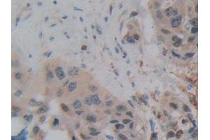 Immunohistochemistry (IHC) image for anti-SP140 Nuclear Body Protein (SP140) (AA 443-655) antibody (ABIN7442387)