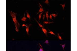 Immunofluorescence analysis of PC12 cells using EGFR Polyclonal Antibody at dilution of 1:100. (EGFR antibody)