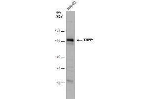 WB Image ENPP1 antibody detects ENPP1 protein by western blot analysis. (ENPP1 antibody)