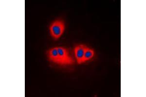 Immunofluorescent analysis of ACOT2 staining in K562 cells. (ACOT2 antibody  (Center))