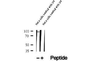 Western blot analysis of extracts of HeLa cells treated with UV, using Phospho-BAP1 (Ser592) Antibody.
