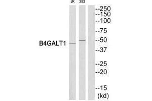 Western blot analysis of extracts from Jurkat/293 cells, using B4GALT1 antibody. (B4GALT1 antibody  (C-Term))