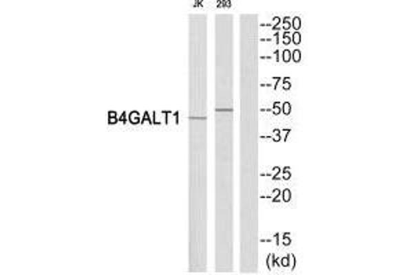 B4GALT1 antibody  (C-Term)