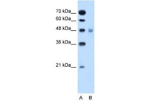 SLC17A4 antibody used at 1 ug/ml to detect target protein. (SLC17A4 antibody)