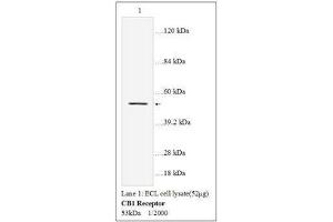 Image no. 1 for anti-Cannabinoid Receptor 1 (CNR1) antibody (ABIN791358) (CNR1 antibody)