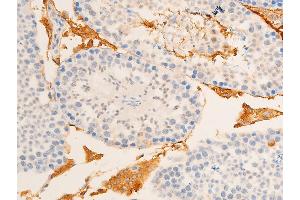Immunohistochemistry (IHC) image for anti-Nuclear Factor of kappa Light Polypeptide Gene Enhancer in B-Cells Inhibitor, epsilon (NFKBIE) (pSer161) antibody (ABIN6255101)