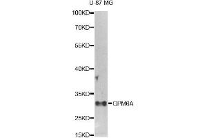 Western blot analysis of extracts of U-87MG cells, using GPM6A antibody. (GPM6A antibody)