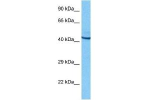 Host:  Rat  Target Name:  POU2F3  Sample Tissue:  Rat Brain  Antibody Dilution:  1ug/ml (POU2F3 antibody  (N-Term))