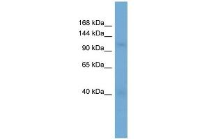 WB Suggested Anti-RANBP5 Antibody Titration: 0. (Importin 5 antibody  (N-Term))