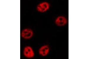 ABIN6277140 staining  HuvEc cells by IF/ICC. (ALOX5 antibody  (C-Term))