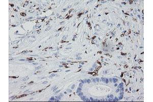 Image no. 1 for anti-Coagulation Factor XIII, A1 Polypeptide (F13A1) antibody (ABIN1498146) (F13A1 antibody)