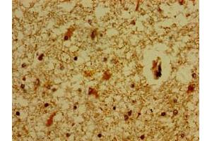 Immunohistochemistry of paraffin-embedded human brain tissue using ABIN7159217 at dilution of 1:100 (MC5 Receptor antibody  (AA 1-37))