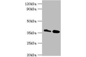 Western blot All lanes: CTSK antibody at 8 μg/mL Lane 1: MCF-7 whole cell lysate Lane 2: Rat brain tissue Secondary Goat polyclonal to rabbit IgG at 1/10000 dilution Predicted band size: 37 kDa Observed band size: 37 kDa (Cathepsin K antibody  (AA 115-329))