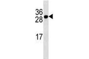 Western Blotting (WB) image for anti-Tumor Necrosis Factor Receptor Superfamily, Member 17 (TNFRSF17) (AA 63-92) antibody (ABIN3029362)