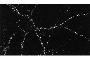Immunocytochemistry/Immunofluorescence analysis using Mouse Anti-PSD95 Monoclonal Antibody, Clone 6G6 . (DLG4 antibody  (Biotin))