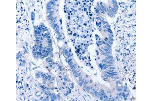 Immunohistochemistry (IHC) image for anti-C-Type Lectin Domain Family 4, Member A (CLEC4A) antibody (ABIN1871908)