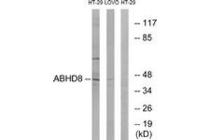 Western blot analysis of extracts from HT-29/LOVO cells, using ABHD8 Antibody. (ABHD8 antibody  (AA 291-340))