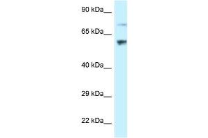 WB Suggested Anti-RSL1D1 Antibody Titration: 1. (RSL1D1 antibody  (C-Term))