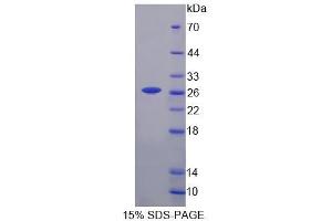 SDS-PAGE analysis of Mouse CASQ Protein. (Calsequestrin Protein)